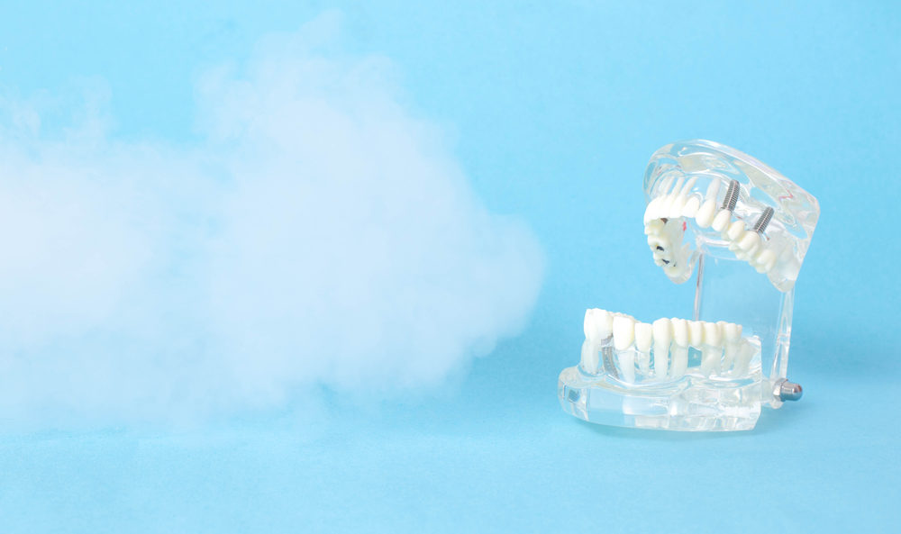 Dental Jaw Model On A Blue Background With Ozone.